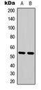 Phosphatase And Tensin Homolog antibody, LS-C358255, Lifespan Biosciences, Western Blot image 