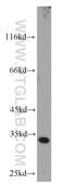 Cyclin Dependent Kinase 4 antibody, 11026-1-AP, Proteintech Group, Western Blot image 