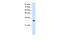 Aminoacyl TRNA Synthetase Complex Interacting Multifunctional Protein 1 antibody, 29-340, ProSci, Western Blot image 