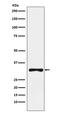 RING1 And YY1 Binding Protein antibody, M04316-3, Boster Biological Technology, Western Blot image 