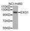 Exonuclease 1 antibody, STJ28893, St John