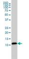 Galectin 1 antibody, H00003956-M01, Novus Biologicals, Western Blot image 
