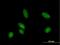 Cytidine Deaminase antibody, H00000978-B02P, Novus Biologicals, Immunocytochemistry image 