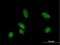 Cytidine deaminase antibody, H00000978-B02P, Novus Biologicals, Immunocytochemistry image 