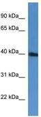 Pre-MRNA Processing Factor 38A antibody, TA343030, Origene, Western Blot image 