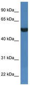 Fibronectin Type III And SPRY Domain Containing 1 Like antibody, TA342991, Origene, Western Blot image 