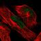 ATRX Chromatin Remodeler antibody, MA5-24609, Invitrogen Antibodies, Immunofluorescence image 