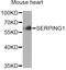 C1 esterase inhibitor antibody, A12407, ABclonal Technology, Western Blot image 