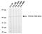 Protein Phosphatase 2 Regulatory Subunit B'Delta antibody, MA5-18066, Invitrogen Antibodies, Western Blot image 