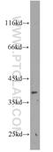 Mab-21 Like 2 antibody, 10971-1-AP, Proteintech Group, Western Blot image 
