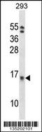 Eukaryotic Translation Initiation Factor 1B antibody, 58-069, ProSci, Western Blot image 