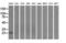 Proteasome 26S Subunit, Non-ATPase 10 antibody, M03169, Boster Biological Technology, Western Blot image 