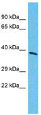 Transcription Factor 7 antibody, TA345423, Origene, Western Blot image 