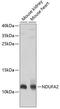 NADH:Ubiquinone Oxidoreductase Subunit A2 antibody, GTX32741, GeneTex, Western Blot image 