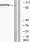 G Protein Regulated Inducer Of Neurite Outgrowth 1 antibody, TA316011, Origene, Western Blot image 