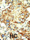TRNA Aspartic Acid Methyltransferase 1 antibody, 55-093, ProSci, Immunohistochemistry paraffin image 