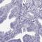 Calcium Binding Protein, Spermatid Associated 1 antibody, HPA044016, Atlas Antibodies, Immunohistochemistry frozen image 