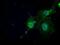 N-Acetyltransferase 8 (Putative) antibody, NBP1-47863, Novus Biologicals, Immunocytochemistry image 