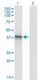 Beta-1,3-Glucuronyltransferase 3 antibody, H00026229-M02, Novus Biologicals, Western Blot image 