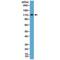 MutS Homolog 2 antibody, M00140-1, Boster Biological Technology, Western Blot image 