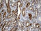 Growth Factor Receptor Bound Protein 7 antibody, M02528, Boster Biological Technology, Immunohistochemistry paraffin image 