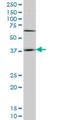 Homeobox D11 antibody, H00003237-M01, Novus Biologicals, Western Blot image 