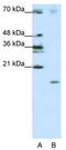 Signal Recognition Particle 19 antibody, TA345833, Origene, Western Blot image 