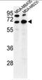 Bestrophin 2 antibody, AP50368PU-N, Origene, Western Blot image 