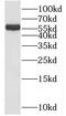 Spire Type Actin Nucleation Factor 2 antibody, FNab08183, FineTest, Western Blot image 