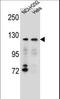 Sorting Nexin 13 antibody, LS-C161363, Lifespan Biosciences, Western Blot image 