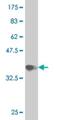 RAB19, Member RAS Oncogene Family antibody, H00401409-M01, Novus Biologicals, Western Blot image 