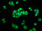 Arrestin Beta 1 antibody, LS-C396192, Lifespan Biosciences, Immunofluorescence image 