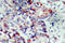 Mitogen-Activated Protein Kinase Kinase 4 antibody, LS-C177947, Lifespan Biosciences, Immunohistochemistry paraffin image 