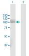 Phosphate Regulating Endopeptidase Homolog X-Linked antibody, H00005251-D01P, Novus Biologicals, Western Blot image 