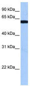 RNA Binding Motif Protein 14 antibody, TA345951, Origene, Western Blot image 
