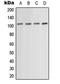 Actinin Alpha 1 antibody, LS-C354227, Lifespan Biosciences, Western Blot image 