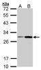 NAD(P)H Quinone Dehydrogenase 1 antibody, LS-C185348, Lifespan Biosciences, Western Blot image 