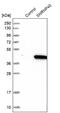 U5 small nuclear ribonucleoprotein 40 kDa protein antibody, NBP1-92586, Novus Biologicals, Western Blot image 