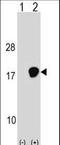 Ubiquitin Conjugating Enzyme E2 D3 antibody, LS-C160378, Lifespan Biosciences, Western Blot image 