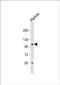 TATA-Box Binding Protein Associated Factor 4b antibody, PA5-48337, Invitrogen Antibodies, Western Blot image 