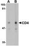 HCLS1-associated protein X-1 antibody, orb75867, Biorbyt, Western Blot image 