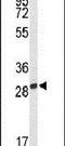 Pyridoxamine 5'-Phosphate Oxidase antibody, PA5-26400, Invitrogen Antibodies, Western Blot image 