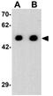 Arrestin-C antibody, GTX31565, GeneTex, Western Blot image 