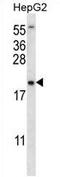 Ubiquitin Conjugating Enzyme E2 N Like (Gene/Pseudogene) antibody, AP54441PU-N, Origene, Western Blot image 