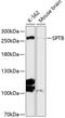 Spectrin Beta, Erythrocytic antibody, 14-765, ProSci, Western Blot image 