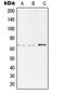 T-Box 18 antibody, GTX55908, GeneTex, Western Blot image 