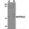 Karyopherin Subunit Alpha 3 antibody, MBS151270, MyBioSource, Western Blot image 