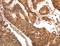 C-C Motif Chemokine Ligand 17 antibody, LS-B15798, Lifespan Biosciences, Immunohistochemistry frozen image 