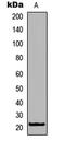 Rhox homeobox family member 1 antibody, GTX56069, GeneTex, Western Blot image 