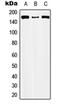 Capicua Transcriptional Repressor antibody, orb215554, Biorbyt, Western Blot image 